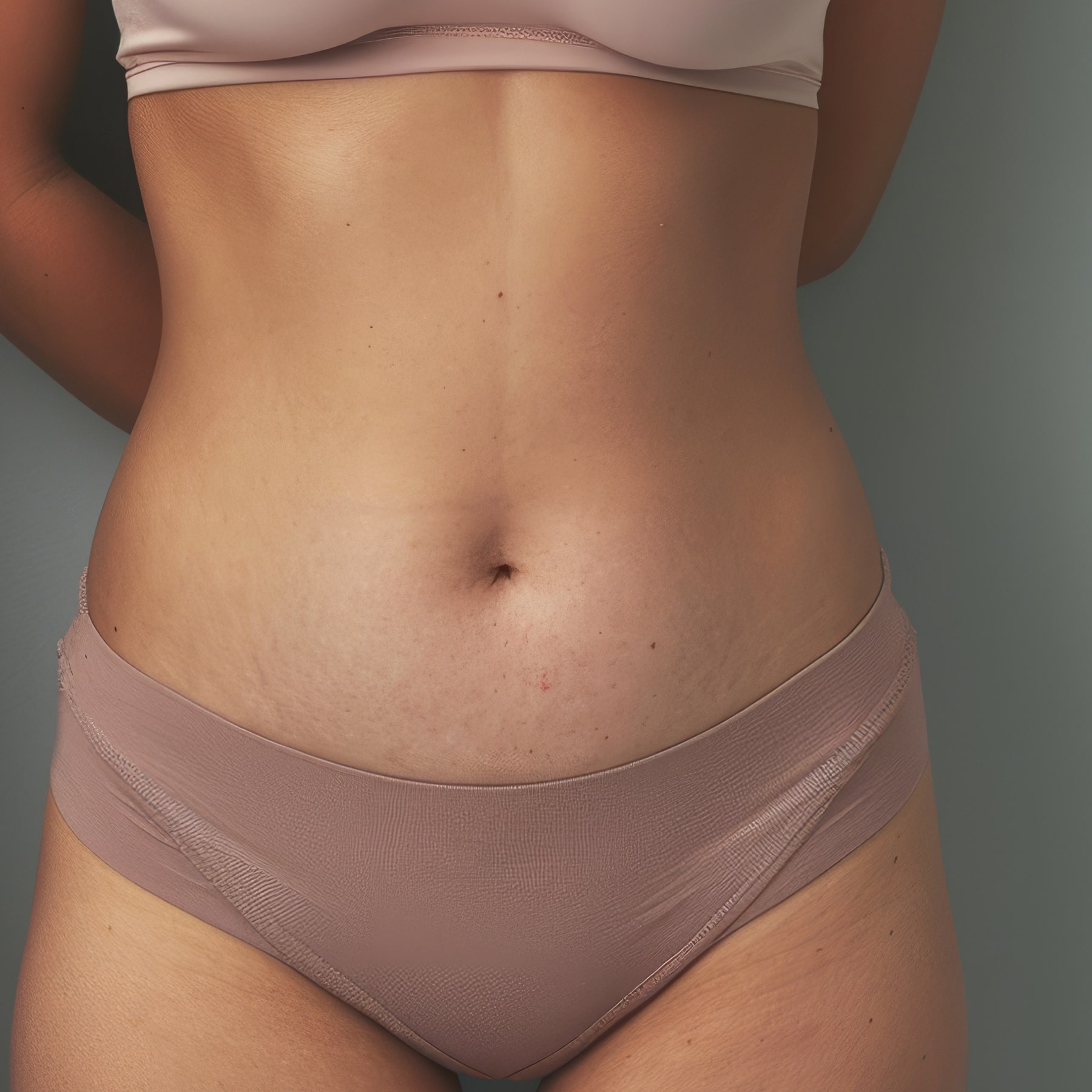 Mini Tummy Tuck imagery